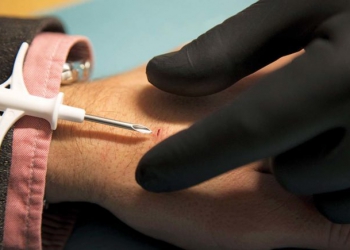 epa05887654 A picture made available on 04 March 2017 of David Holecek (L) getting a chip implanted in his hand by Jowan Osterlund of the company Biohax, in Gothenburg, Sweden, 02 December 2015. The microchip, the size of grains of rice functions as swipe cards: to open doors, operate printers, or buy smoothies with a wave of the hand. According to reports, a Swedish startup company started implanting its workers such chips in January 2015.  EPA/BJORN LARSSON ROSVALL SWEDEN OUT SWEDEN OUT