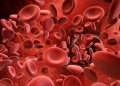 Έχετε χαμηλό αιματοκρίτη; Οι φυσιολογικές τιμές και τα αίτια